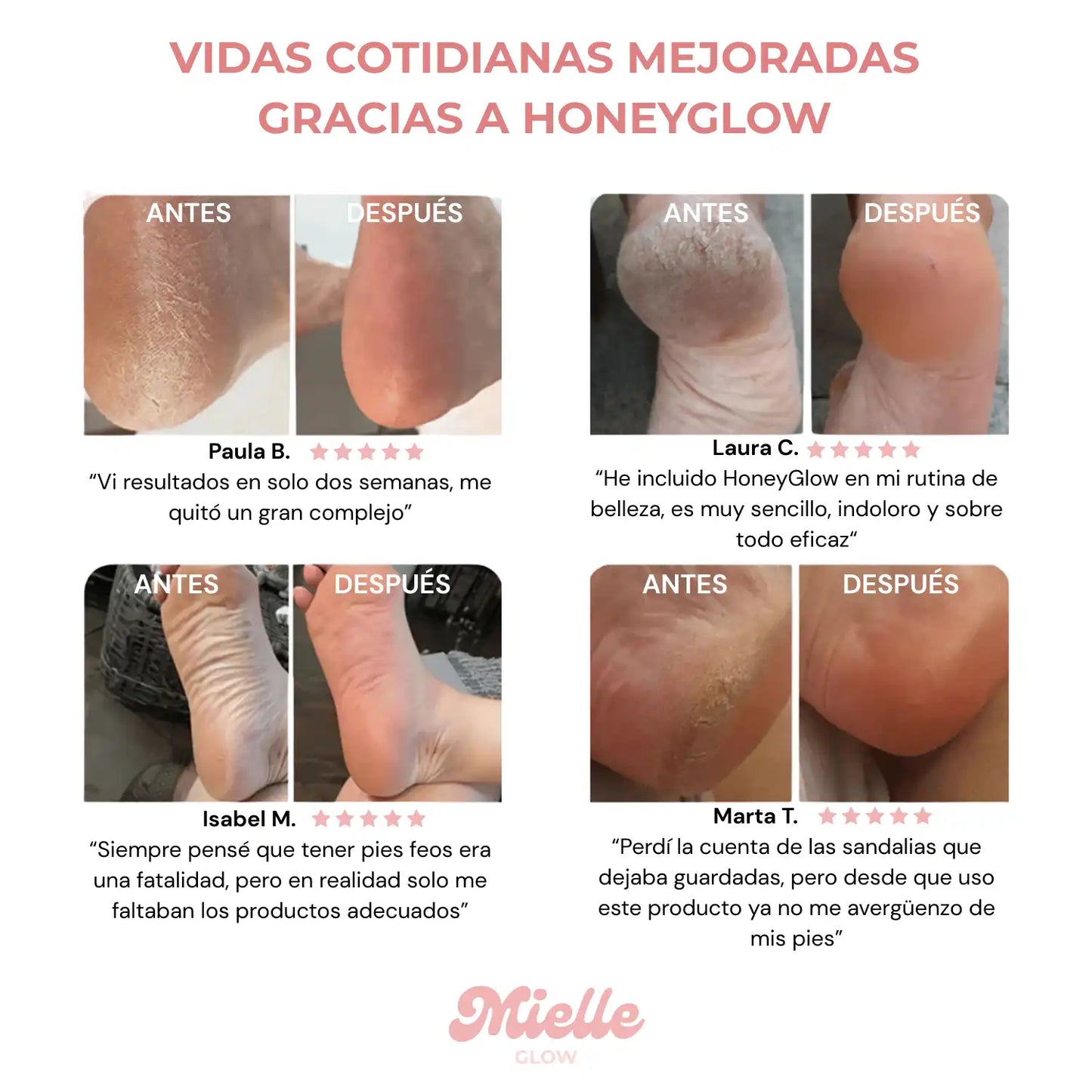 ✨ HoneyGlow™ – Kit para el cuidado de los pies